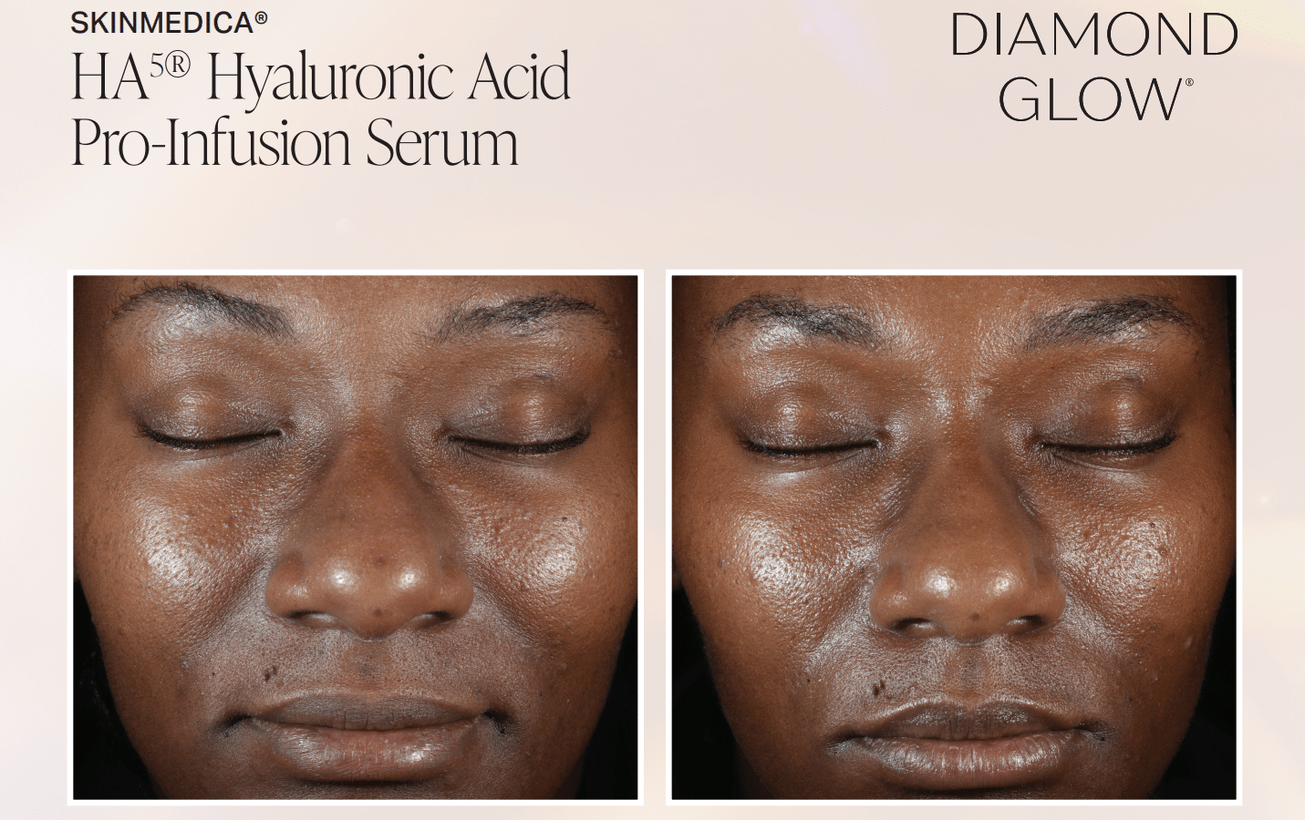 ha serum