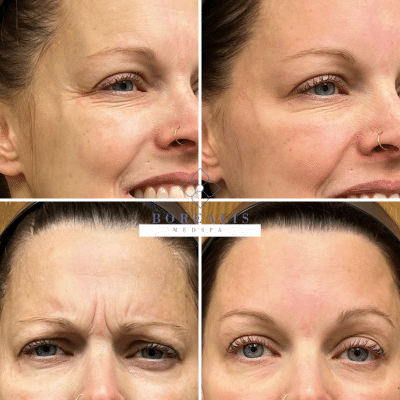 B&A 2