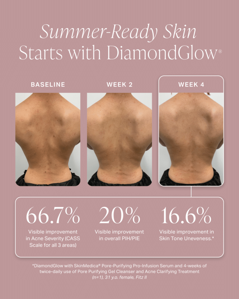 Summer Ready Skin Graphic